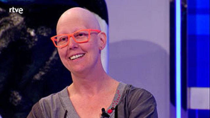  - Perdió todo el pelo. Vijar a EEUU le cambió la vida