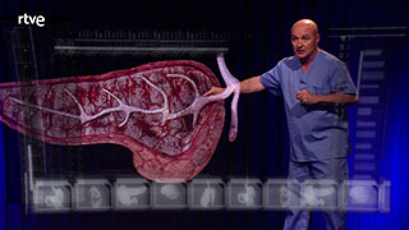  Explicamos claramente qué es una pancreatitis