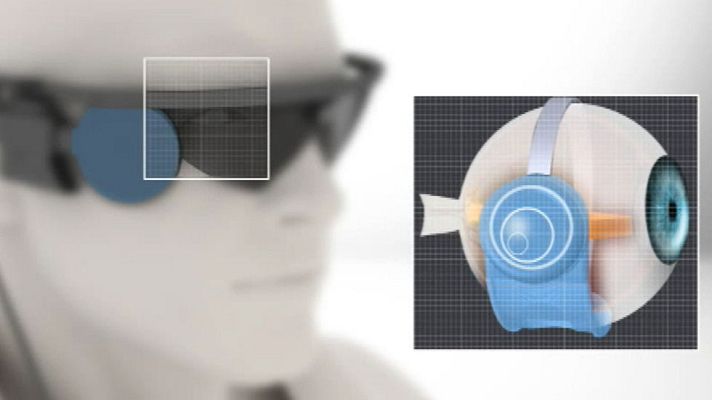 Telediario 1 - Realizado el primer implante de un ojo biónico en a una persona sordo-ciega en Barcelona