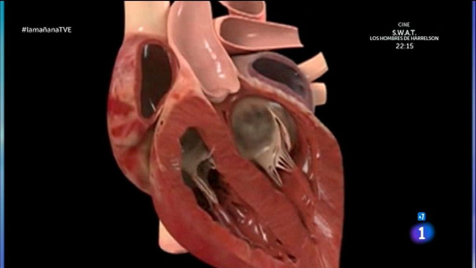 Corazón bajo vigilancia