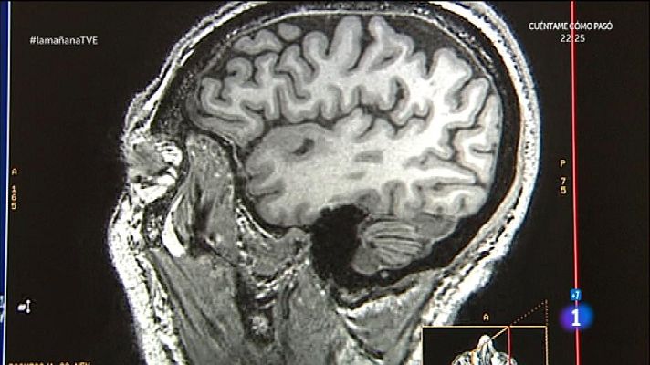 La mañana - Hormonas y cerebro