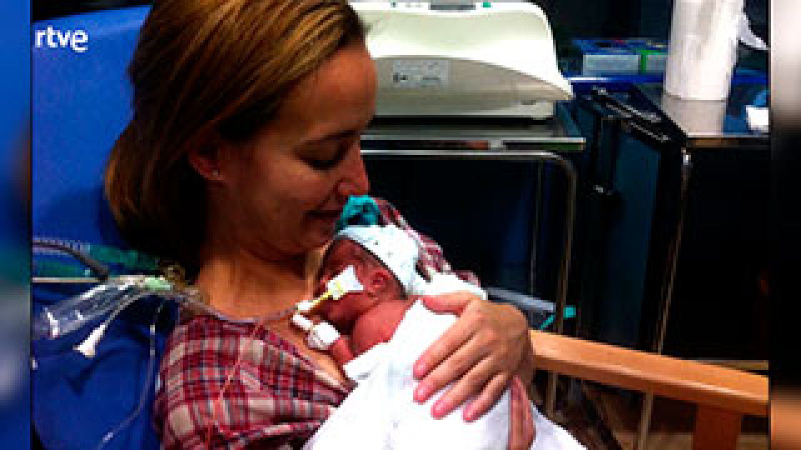  El 55% de los prematuros logran sobrevivir sin grandes secuelas