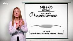 Esto es vida- Si estás cansado de tener callos, te explicamos cómo eliminarlos