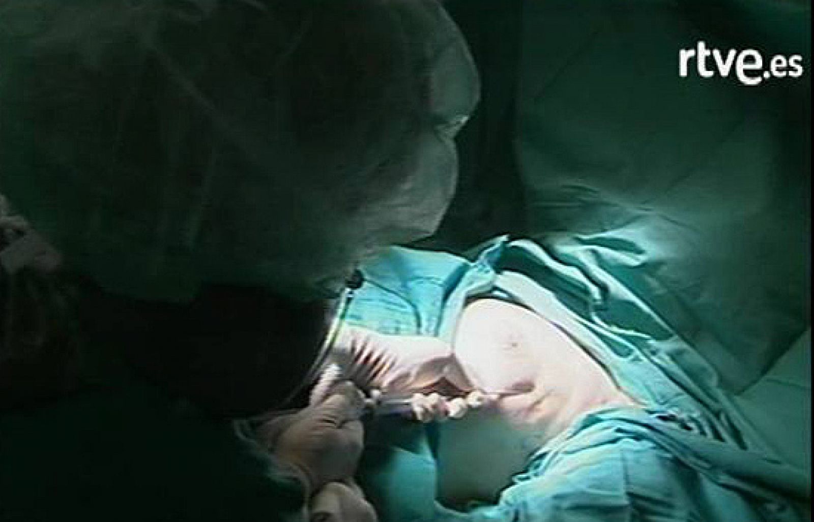 Intervención para reconstruir el pecho con células madre de la grasa - Ciencia y tecnología en Rtve.es | Ver