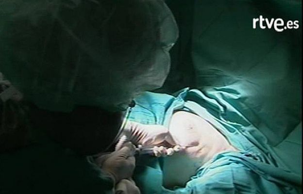 Ciencia y tecnología en Rtve.es - Reconstruir el pecho con células