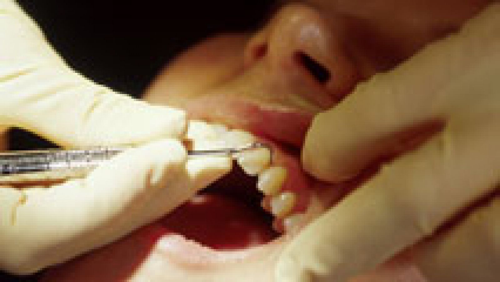 Informativo 24h: Los dentistas creen que se repetirán casos como el de Vitaldent | RTVE Play