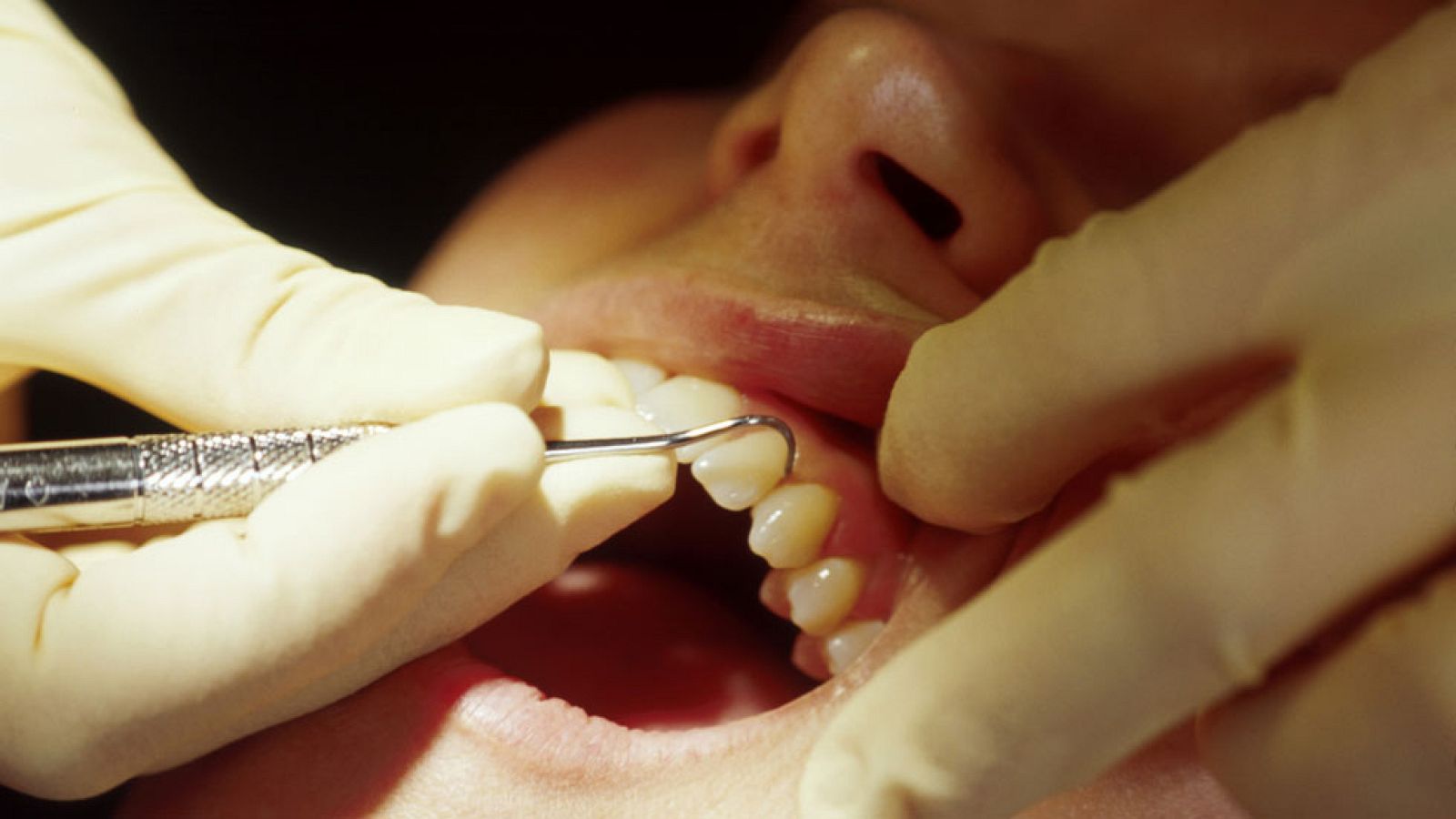 Los dentistas creen que se repetirán casos como el de Vitaldent