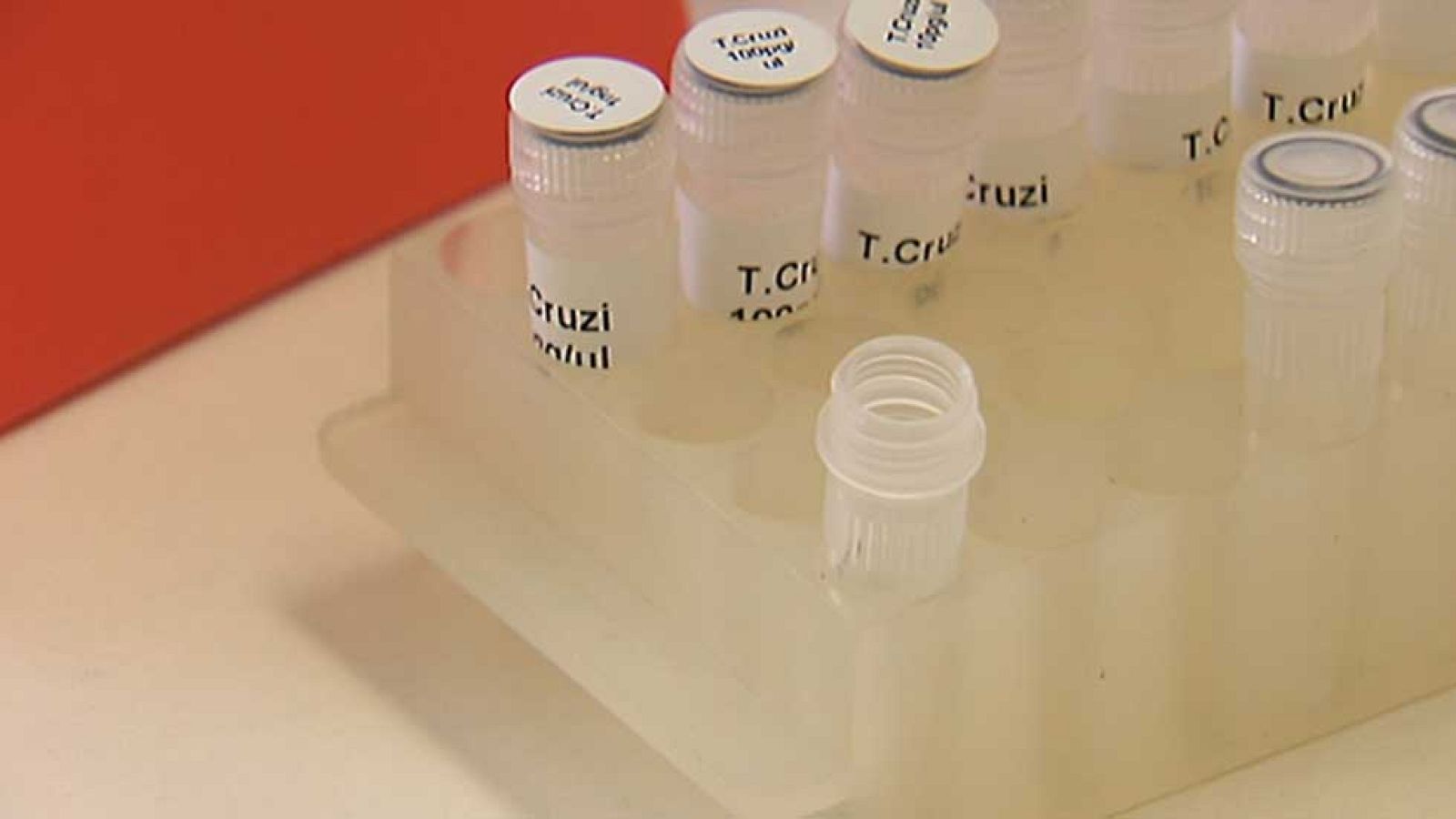 En España ya son veintitrés los casos de zika diagnosticados