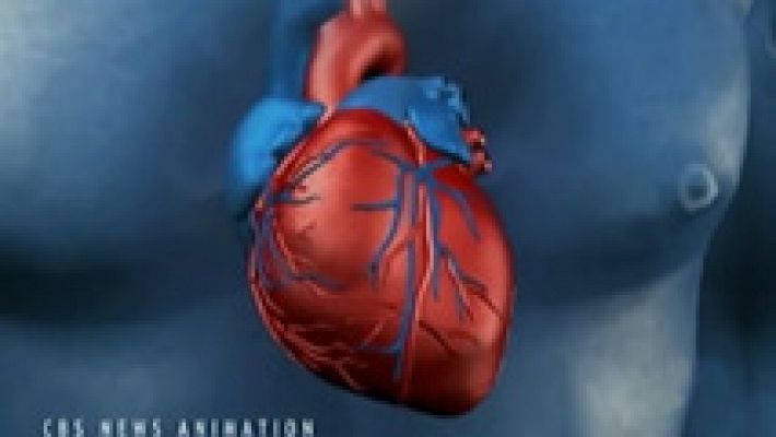 Telediario 1 - La felicidad puede perjudicar al corazón