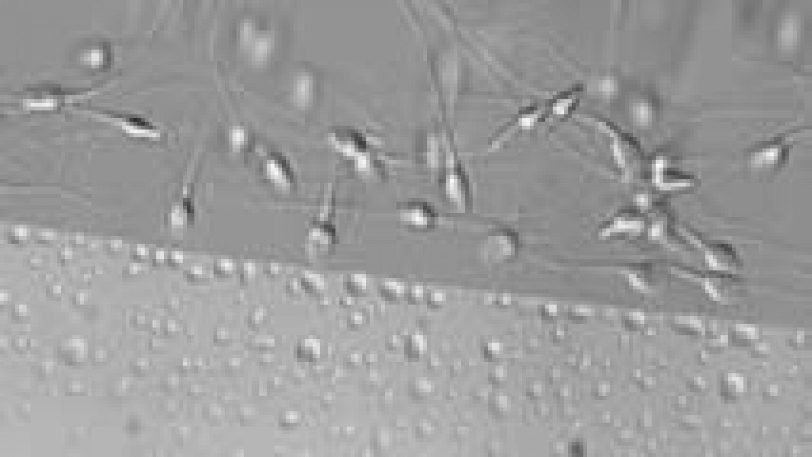 Tres de cada diez hombres en edad fértil tiene semen de mala calidad