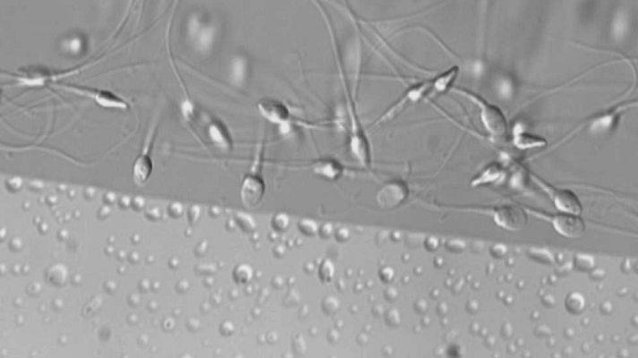 Telediario 1 - Tres de cada diez hombres en edad fértil tienen semen de mala calidad