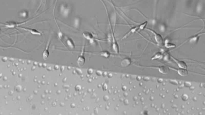 Tres de cada diez hombres en edad fértil tiene semen de mala calidad
