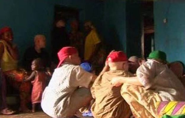  - Albinos en peligro de extinción