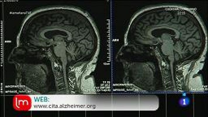 La mañana - Olvidos por edad, olvidos por enfermedad