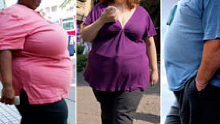 El 55% de los obesos "aparentemente sanos" son "fofisanos"