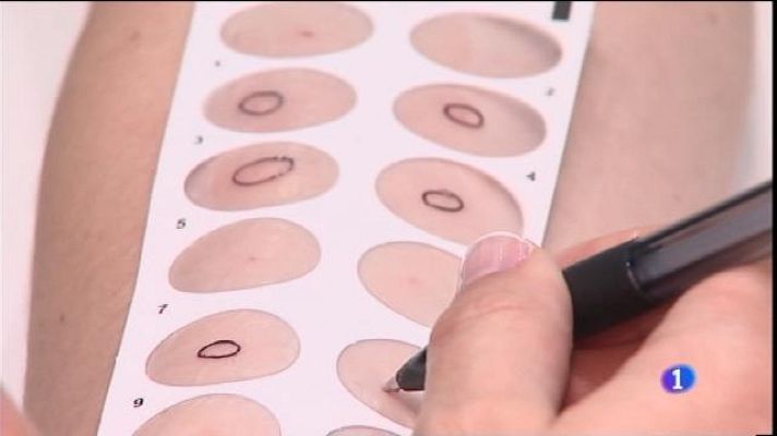 Informatiu Balear - L'única comunitat sense al·lergòleg