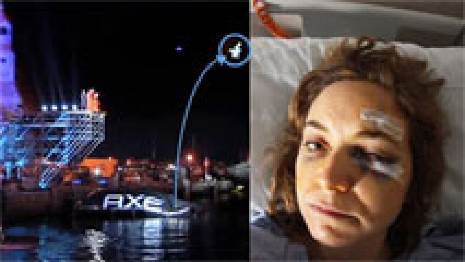 Telediario 1: Una mujer denuncia a AXE por los daños físicos ocasionados en un concurso para ir al espacio | RTVE Play