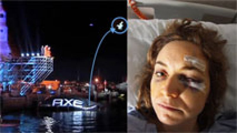 Una mujer denuncia a AXE por los daños físicos ocasionados en un concurso para ir al espacio