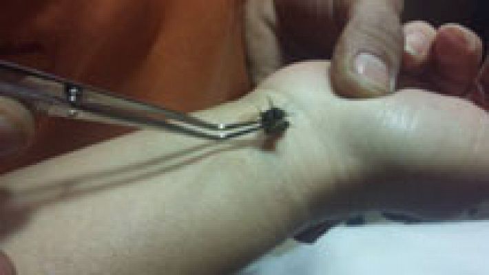 España Directo - ¿Qué es la apiterapia?