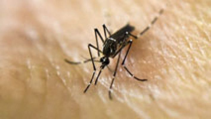 Detectado el primer caso en España de un feto con microcefalia por el virus del Zika