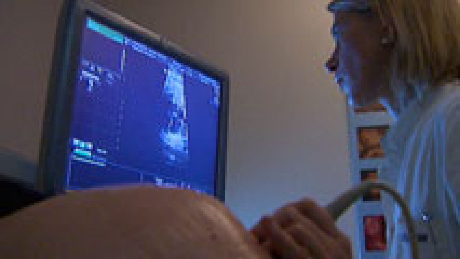 Los científicos aún no han podido precisar la relación causa-efecto entre el Zika y la microcefalia