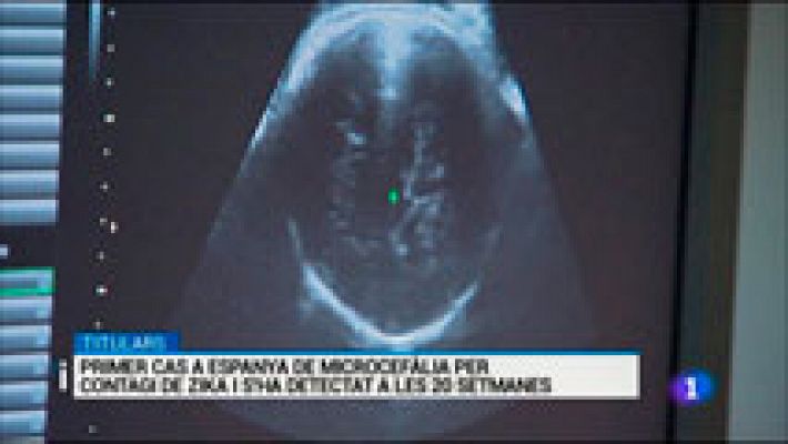 L'Informatiu - L'Informatiu 2 - 06/05/2016