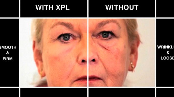 Telediario 1 - Científicos estadounidenses desarrollan una piel artificial con efecto rejuvenecedor