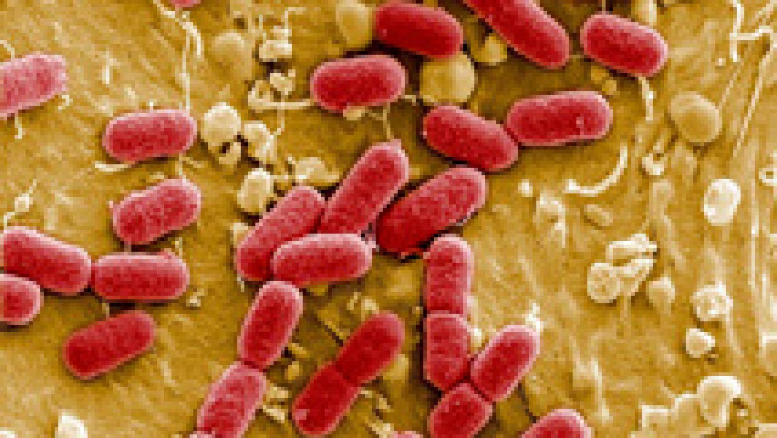 Telediario 1: Preocupación en EE.UU. ante el primer caso de una bacteria que resiste a todos los antibióticos | RTVE Play