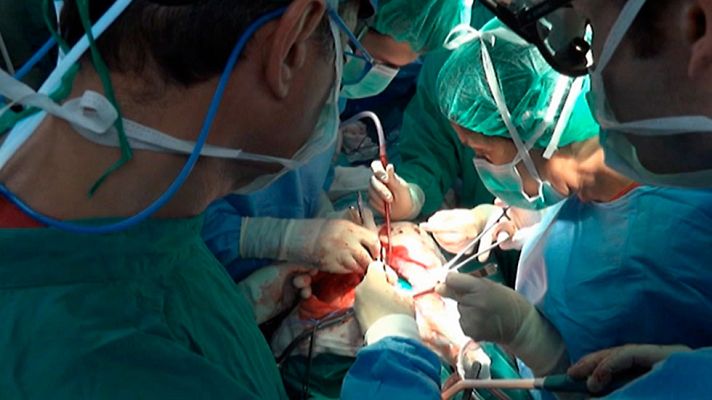 Telediario 1 - Se celebra el Día del Donante con España a la cabeza de donaciones y  trasplantes