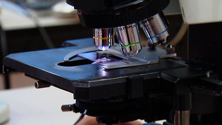 Telediario 1 - Científicos del CNIO investigan la identificación temprana de los tumores provocados por lunares de piel