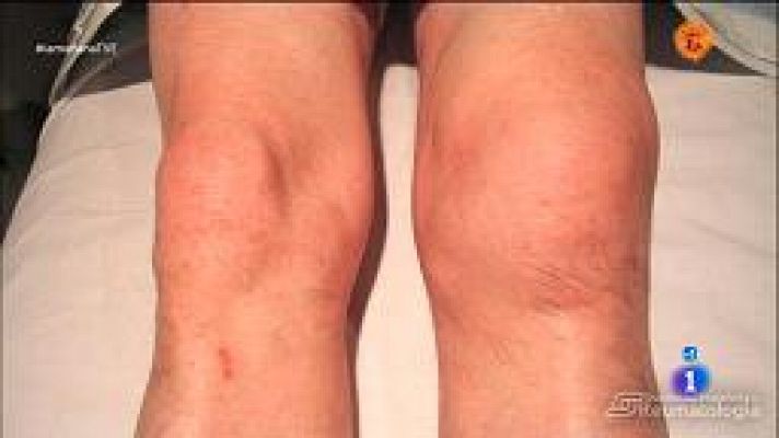 La mañana - Movimiento de articulaciones