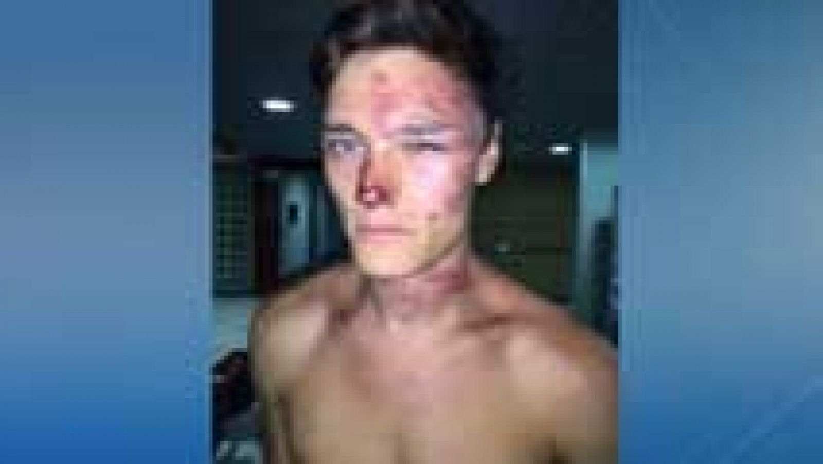 Dos turistas británicos denuncian haber recibido una paliza por parte de los vigilantes de un hotel en Magaluf