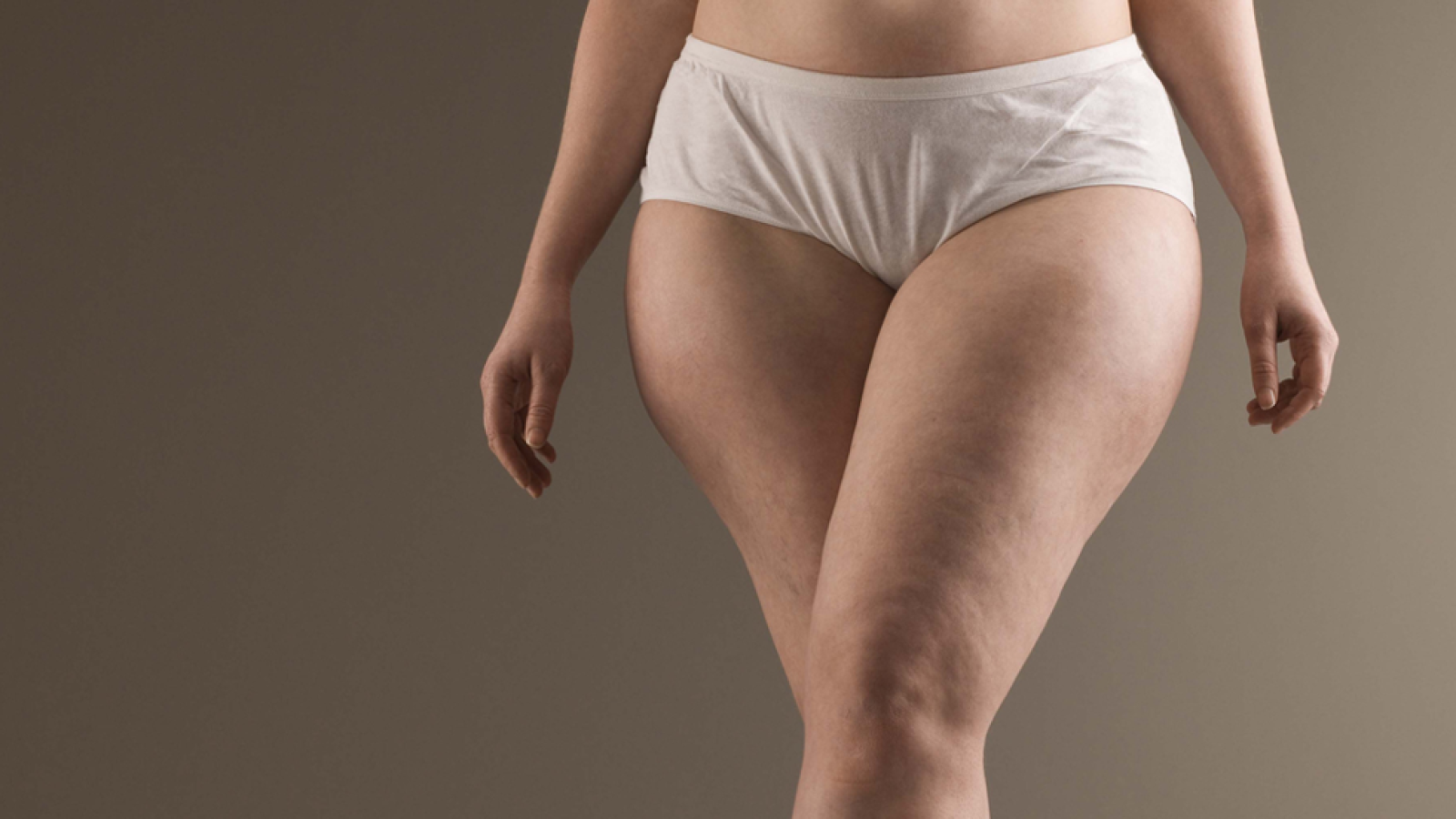 Saber Vivir - La Celulitis