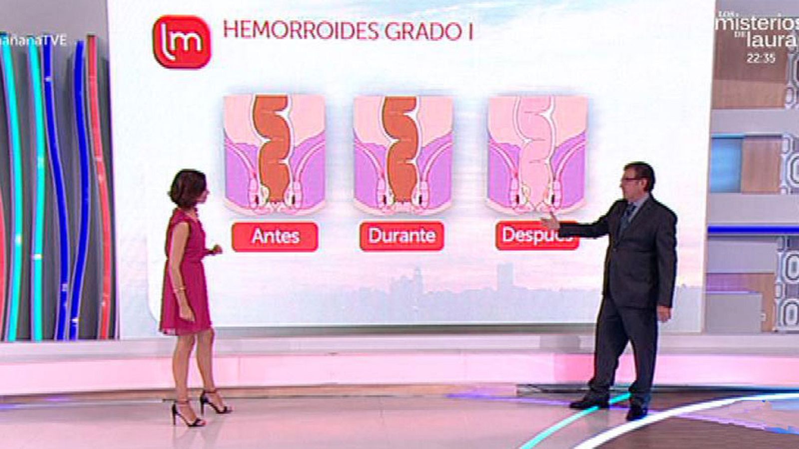 Saber Vivir - Tipos de hemorroides