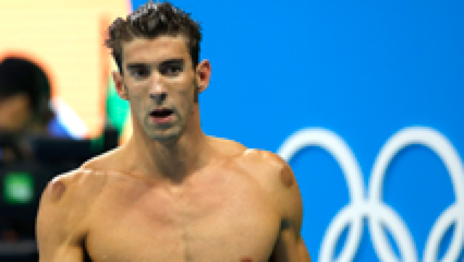 La mañana- Así es la terapia de ventosas que sigue Michael Phelps