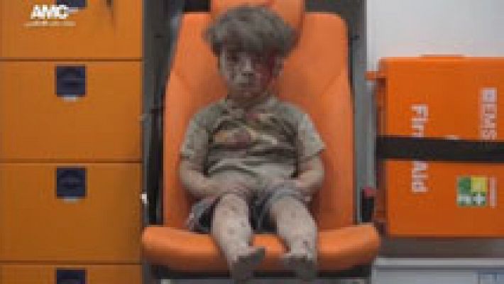 La imagen de un niño herido llama la atención sobre el drama de Alepo