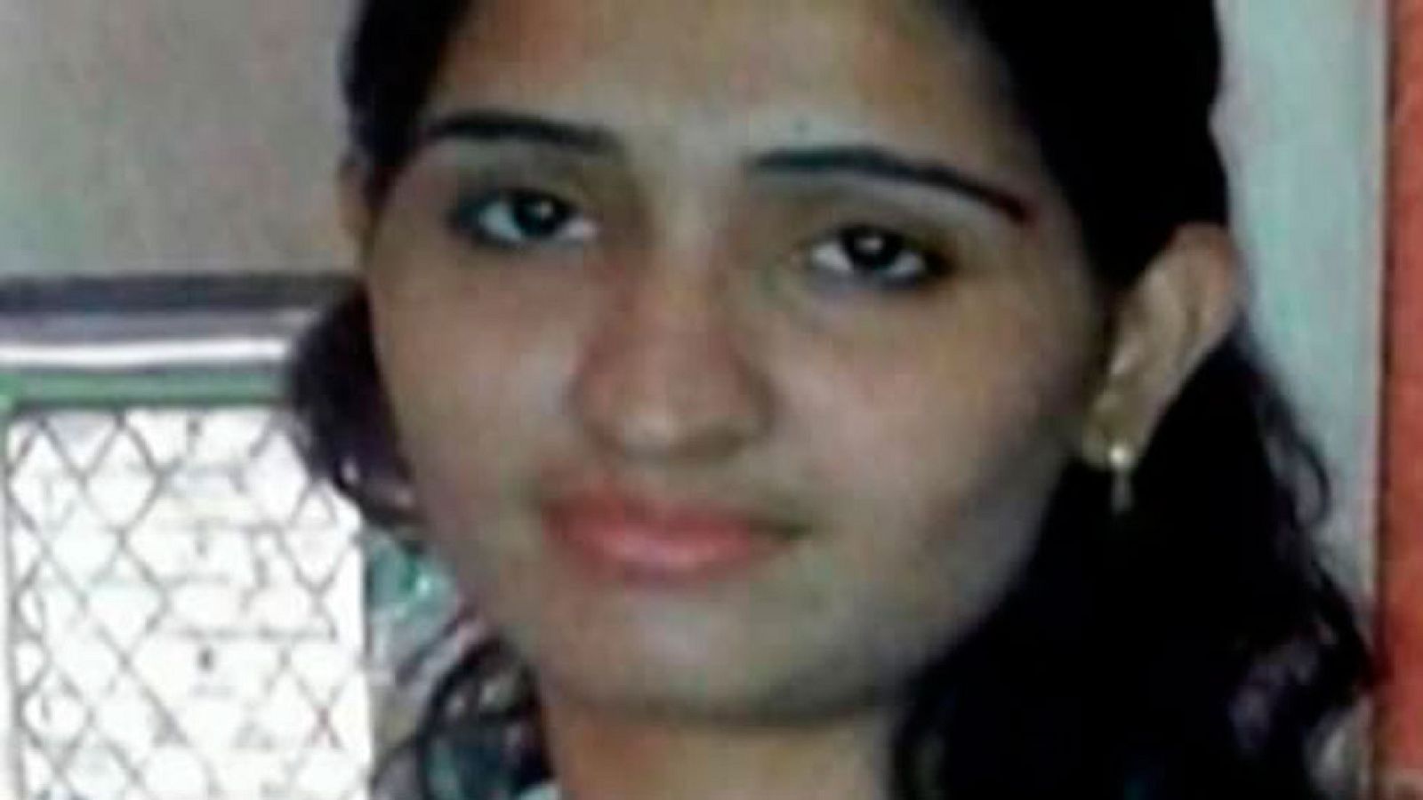 Una joven con el rostro desfigurado desfilará en la Semana de la Moda de New York