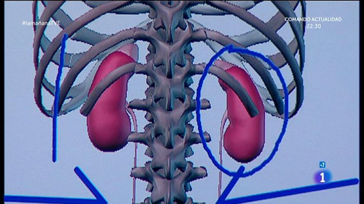 La mañana - Cuida tus riñones
