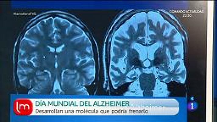Día mundial del Alzheimer