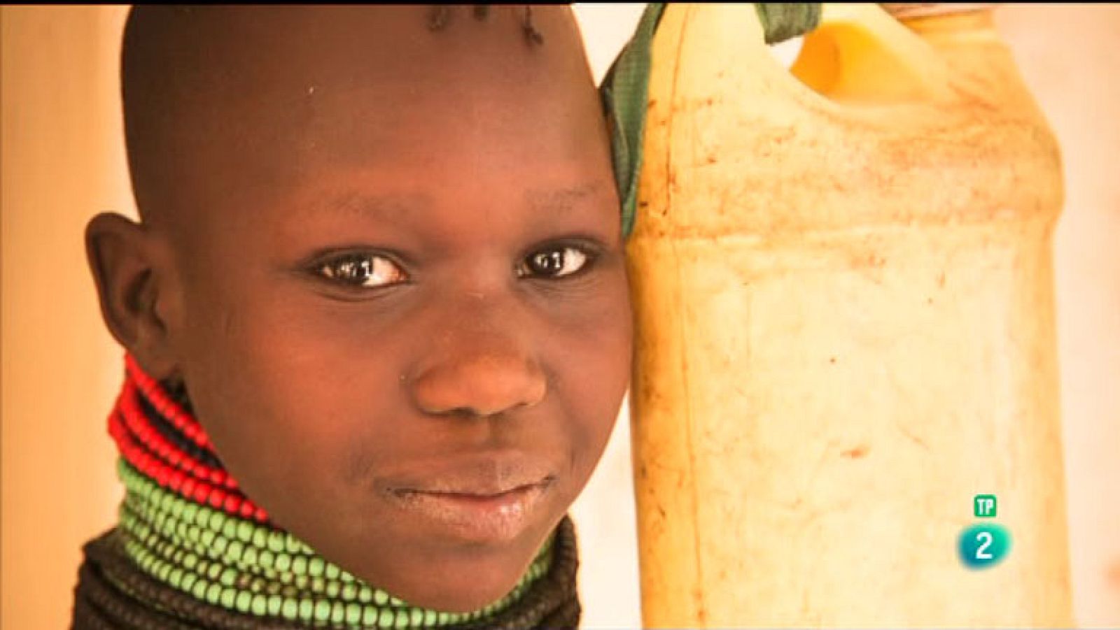 La Aventura del Saber. Cirugía en Turkana 2004 en Lodwar, un rincón al norte de Kenia