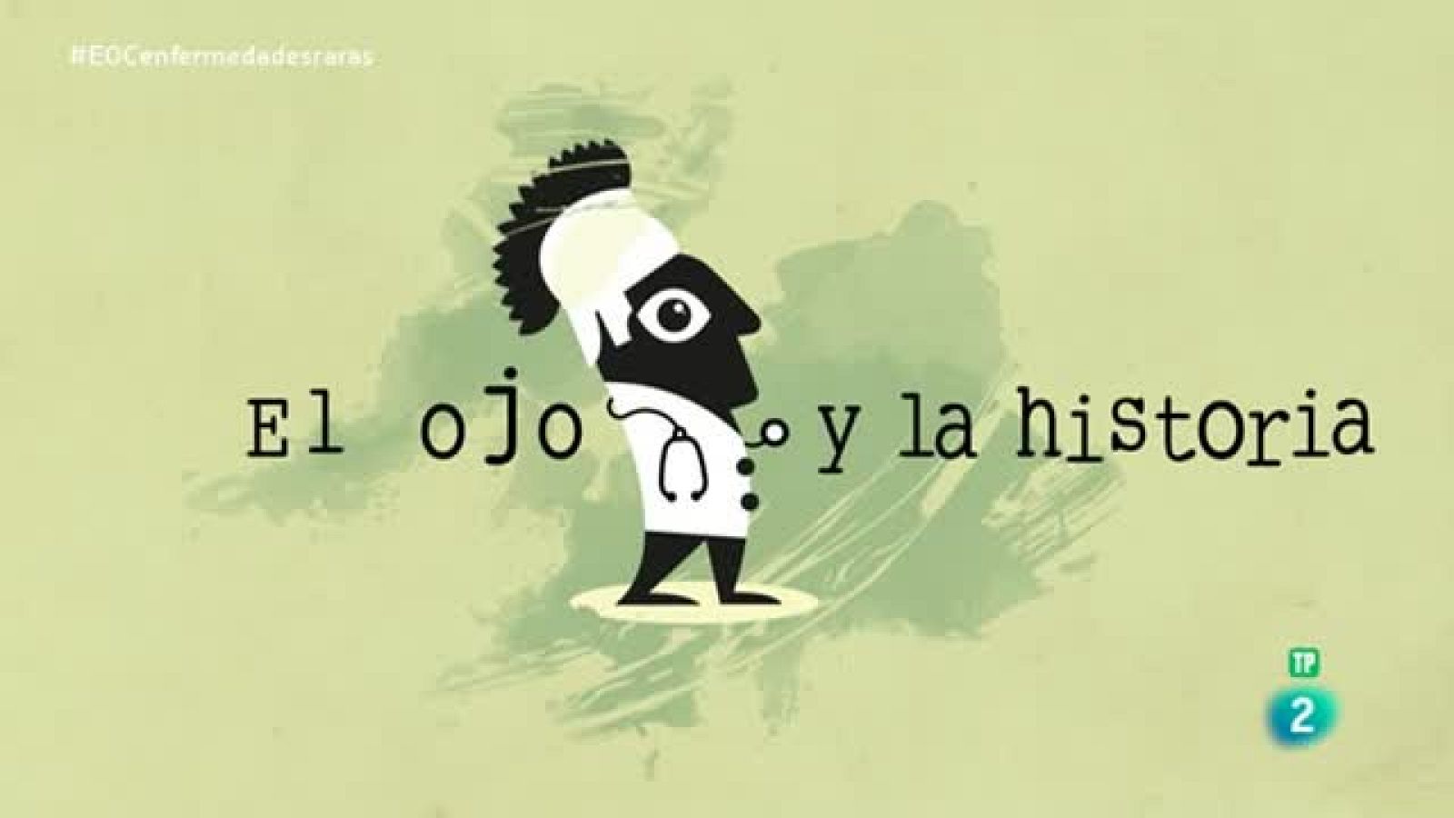 el ojo clinico- Abraham Lincoln padecía la Síndrome de Marfan