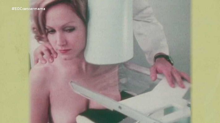 El Ojo Clínico - Cáncer de mama