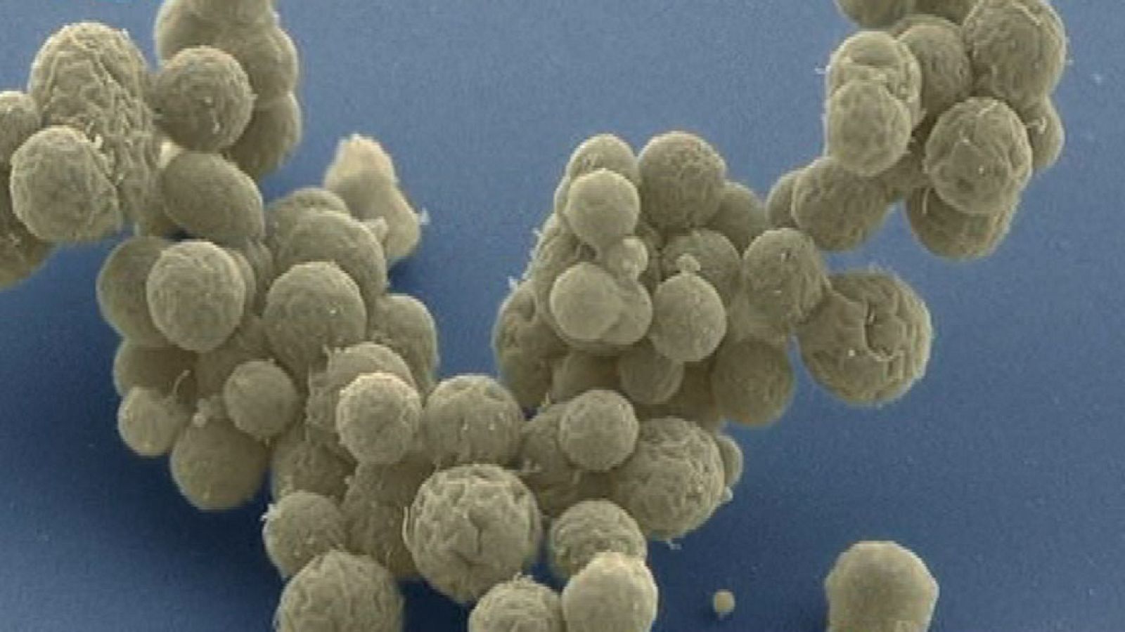 Órbita Laika - Genética - El futuro ya está aquí