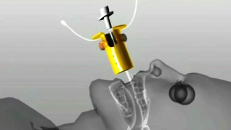 Fábrica de ideas - Inventa: CLIP-FAB