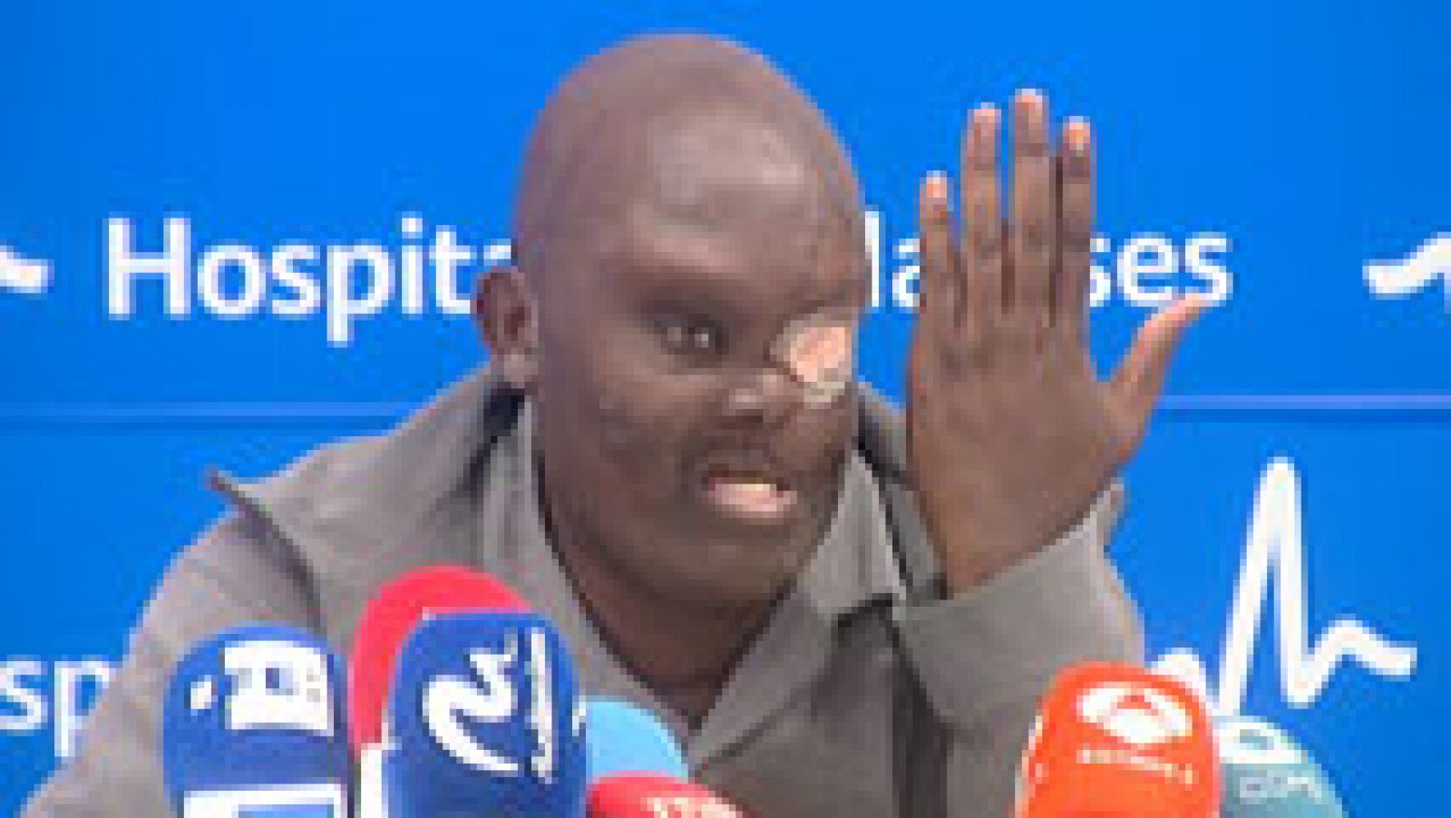 Mike procedente de Kenia es operado de un tumor del tamaño de su cabeza en España para ganar calidad y años de vida