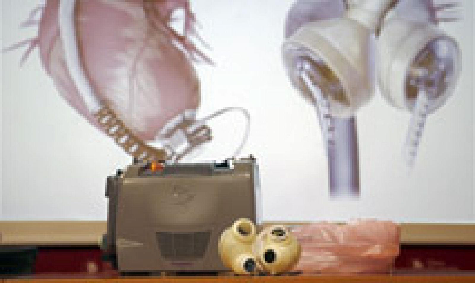 Telediario 1: Un equipo médico de Navarra implanta por primera vez un corazón artificial a un paciente en España | RTVE Play