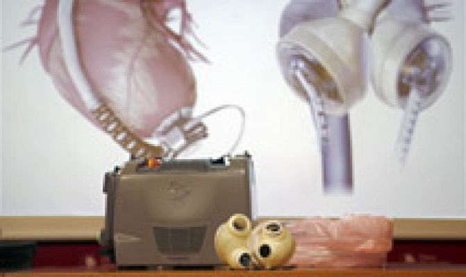 Telediario 1 - Un equipo médico de Navarra implanta por primera vez un corazón artificial a un paciente en España