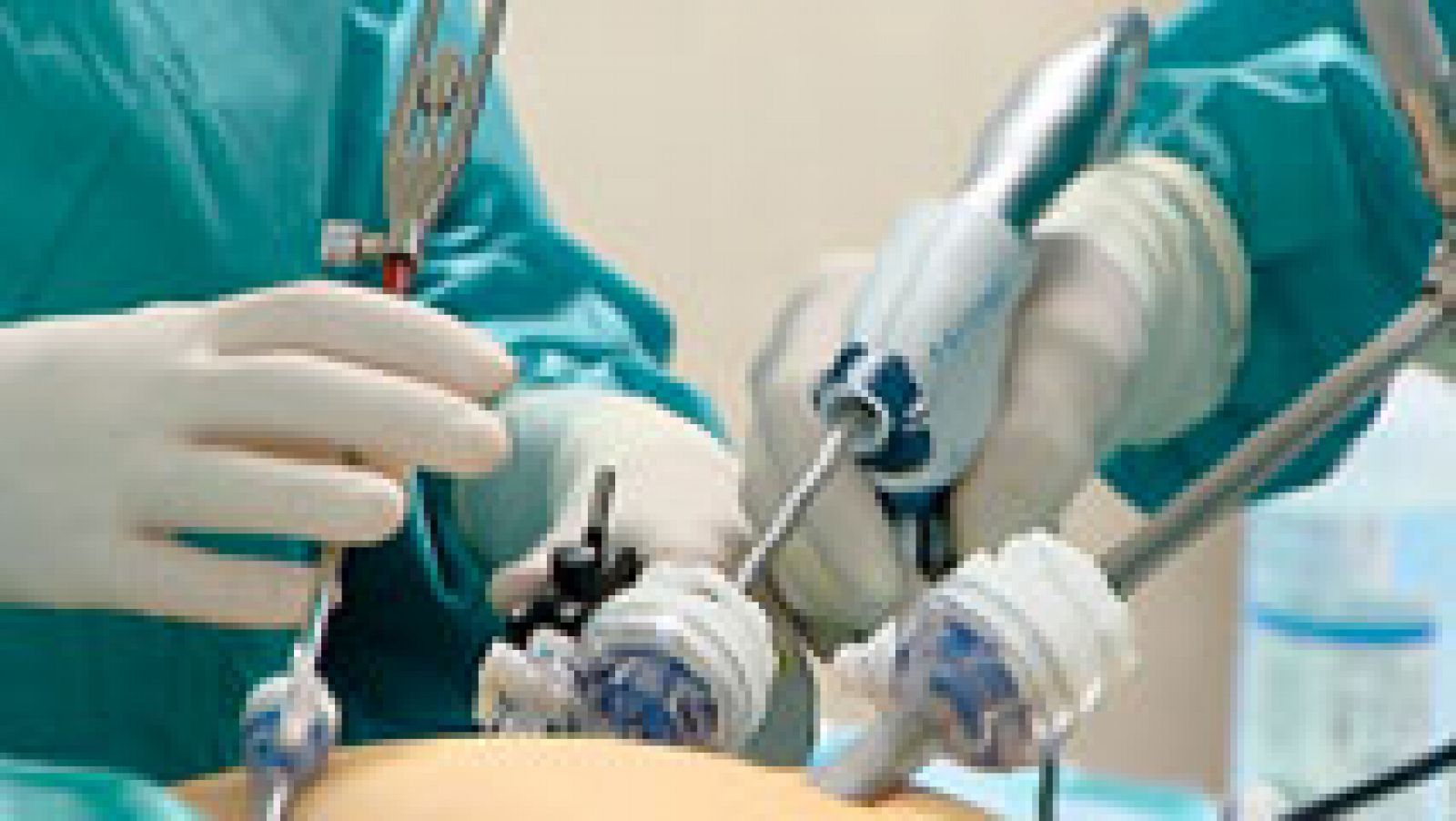 El equipo de TVE ha sido testigo de una cirugía laparoscopia