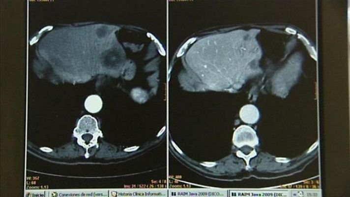 Telecanarias - Canarias en 2' - 04/02/2017