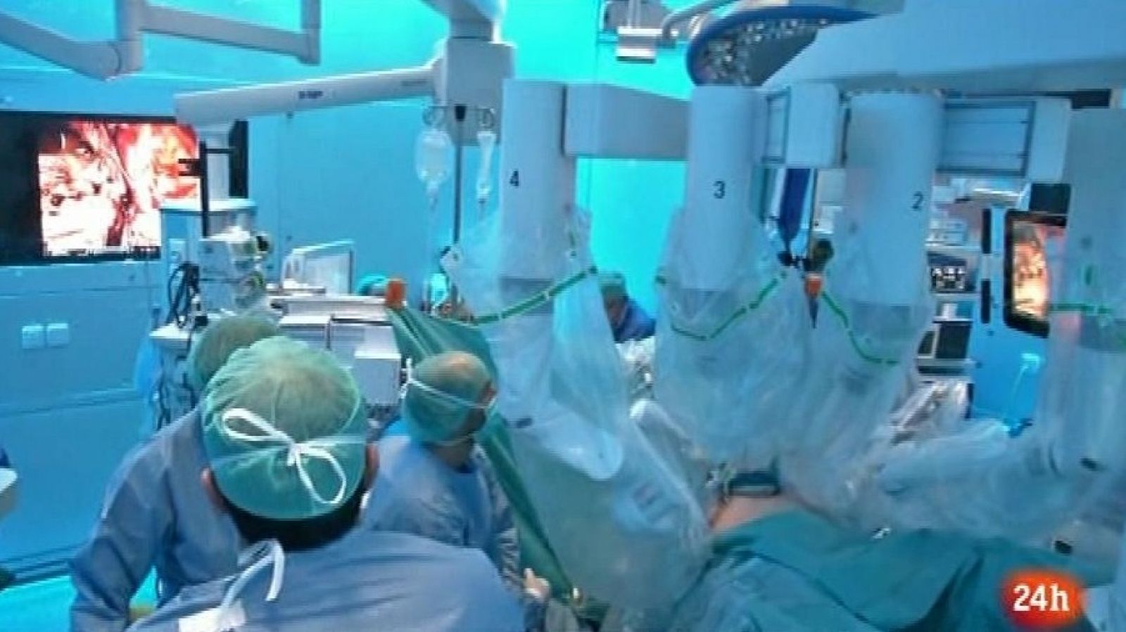 Parlamento - El reportaje - Organización Nacional de Trasplantes - 18/03/2017